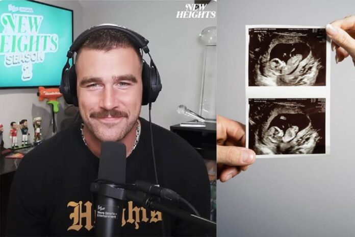 Congratulations to Travis Kelce as he shows the scan and announced the pregnancy of his… Read More