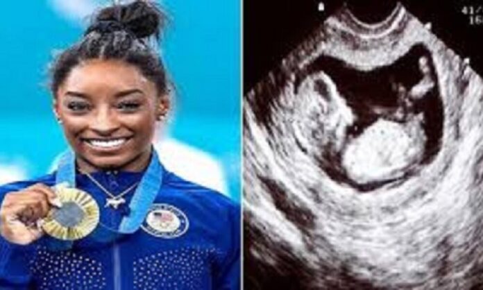 BREAKING: Report from fox news says the Gold Medalist Simone Biles Is Pregnant at the 2024 Olympics. “3 weeks gone”… See more